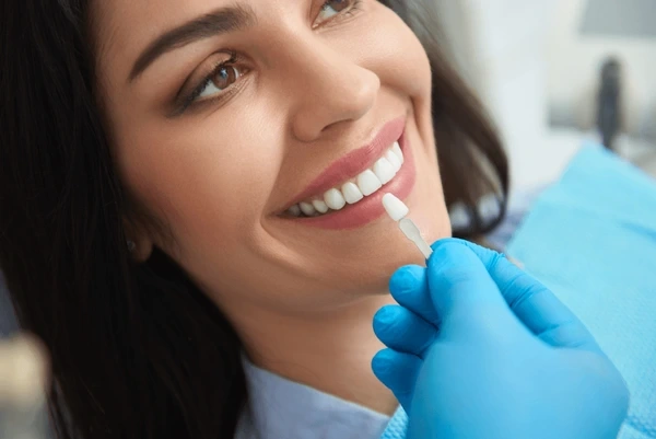 bonded veneers near you