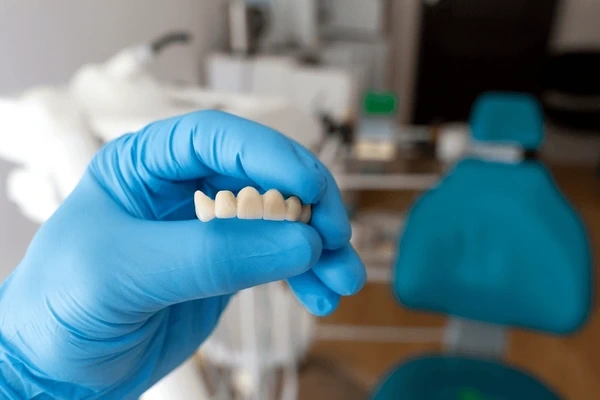 dental bridges near you