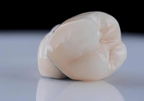 dental crowns in riverdale