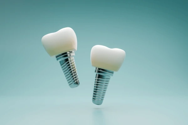 dental implants in riverdale