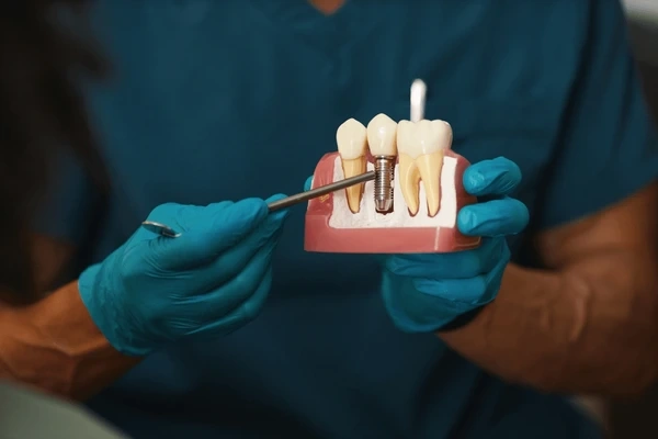 dental implants near you