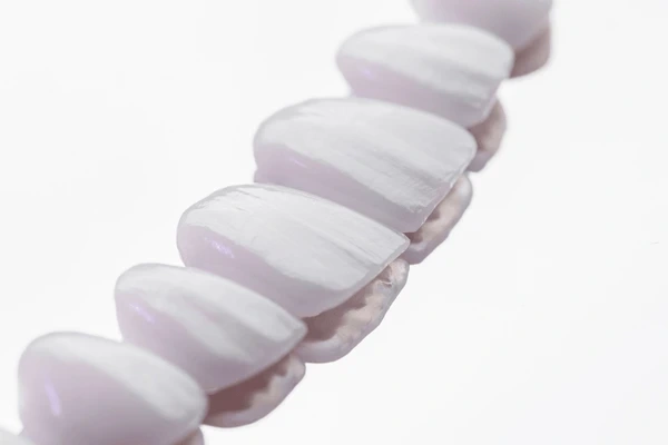 dental veneers near you