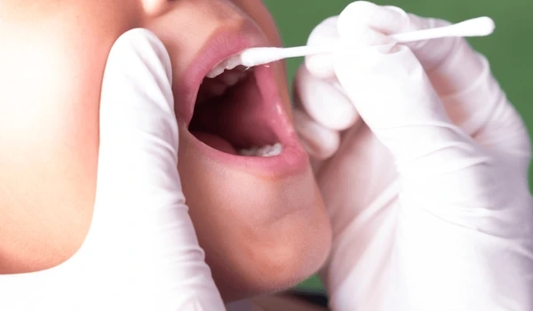 fluoride treatments in riverdale