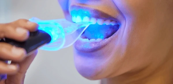 zoom whitening in riverdale