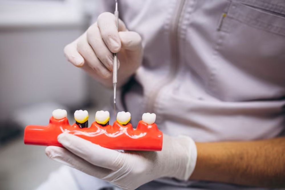 dentist examining dental crowns on a model of restored teeth